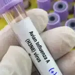 Bird flu