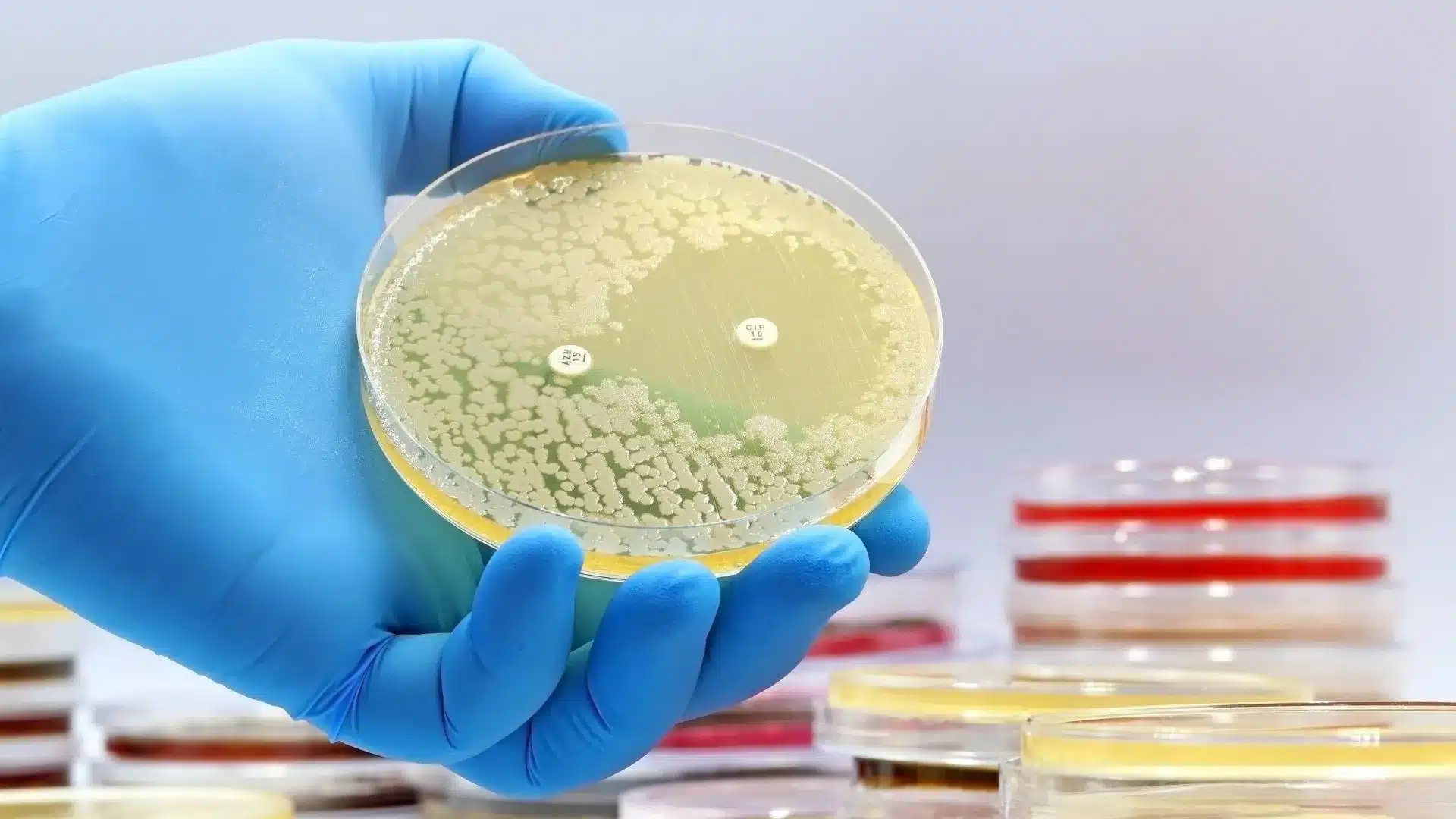 Antibiotic resistance