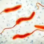 Cholera