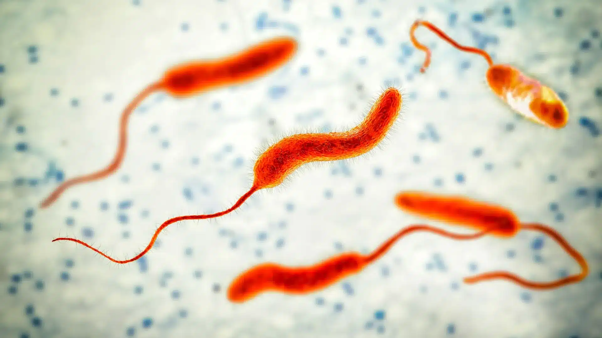 Cholera