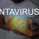 Hantavirus