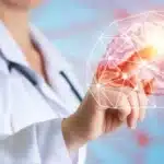 Stroke